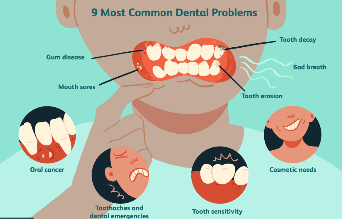 Emergency Dentist